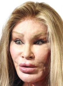 Джоселин-Вильденштейн 