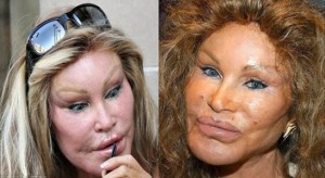 Джоселин Вильденштейн