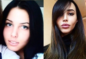 Анастасия Волконская Решетова до пластики. Фото