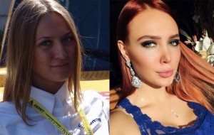 Лиза Полыгалова до пластики. Фото