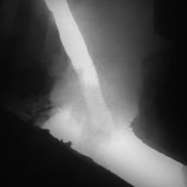 промышленность-алюминия